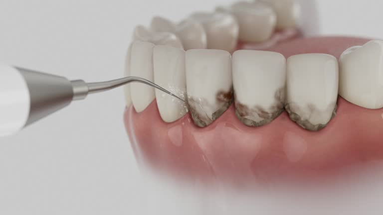 Trusted Invisalign Clear Aligners service in Valentine, NE - Dentist Open Now